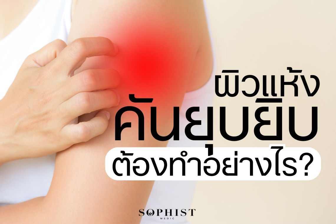 ผิวแห้งเป็นขุย ผิวแห้ง คันยุบยิบเกิดจากอะไร พร้อมวิธีรักษาผิวแห้งเสีย - sophistmedic