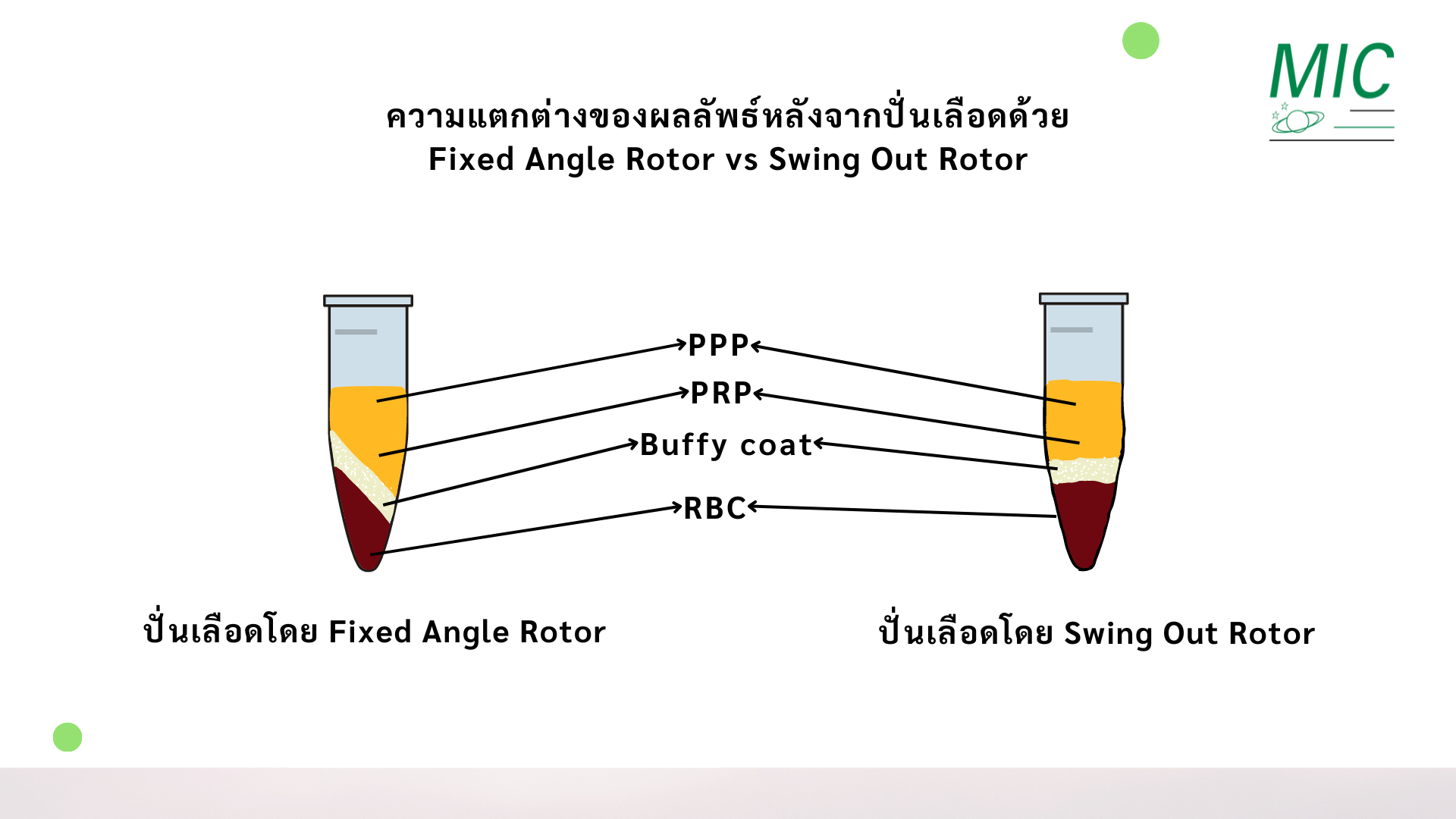 ความแตกต่างของการใช้งาน PRP Tube กับ Tube ทั่วไป