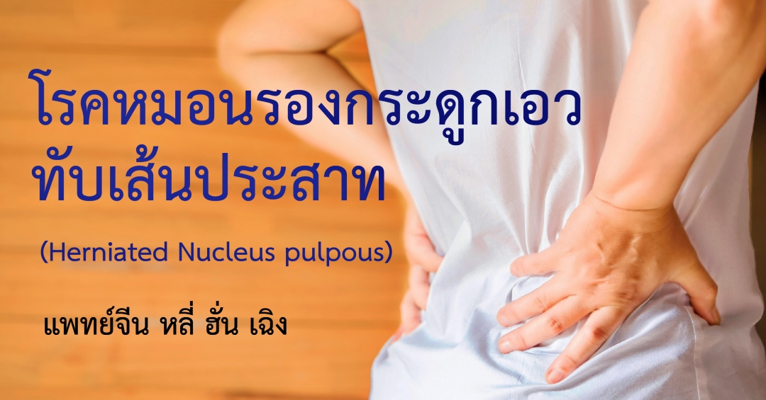 โรคหมอนรองกระดูกเอวทับเส้นประสาท (Herniated Nucleus pulpous)