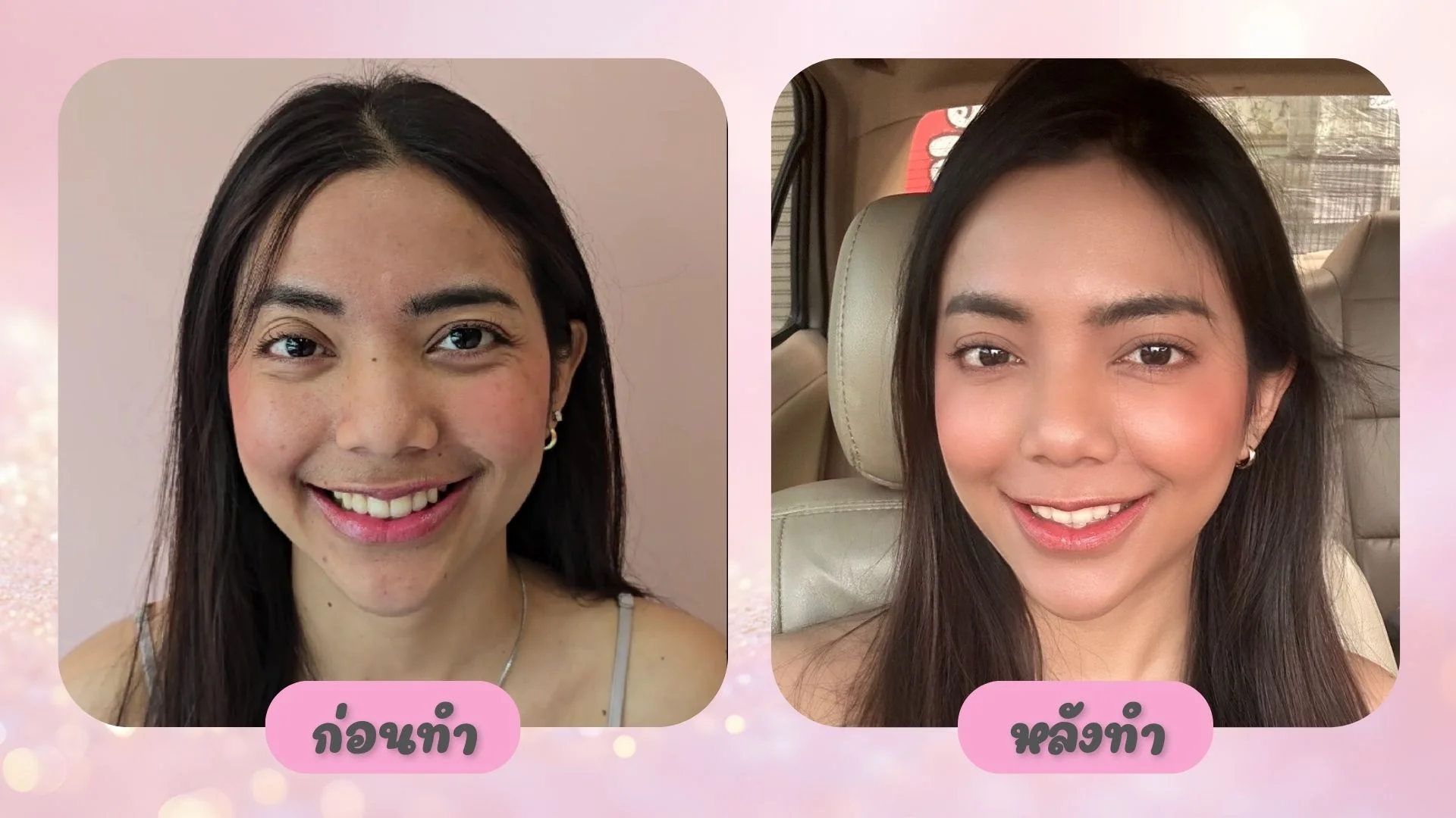 ก่อนและหลังทำเคสคุณโป๊ยเซียน