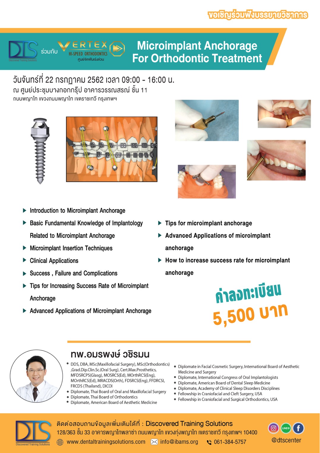 Microimplant Anchorage For Orthodontic Treatment