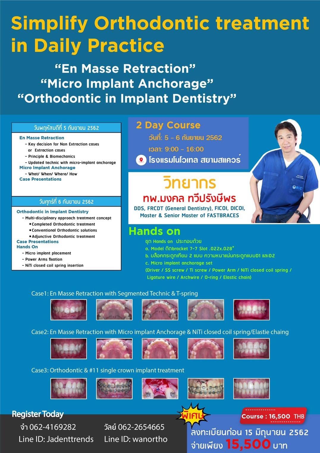 Simplify Orthodontic treatment in Daily Practice