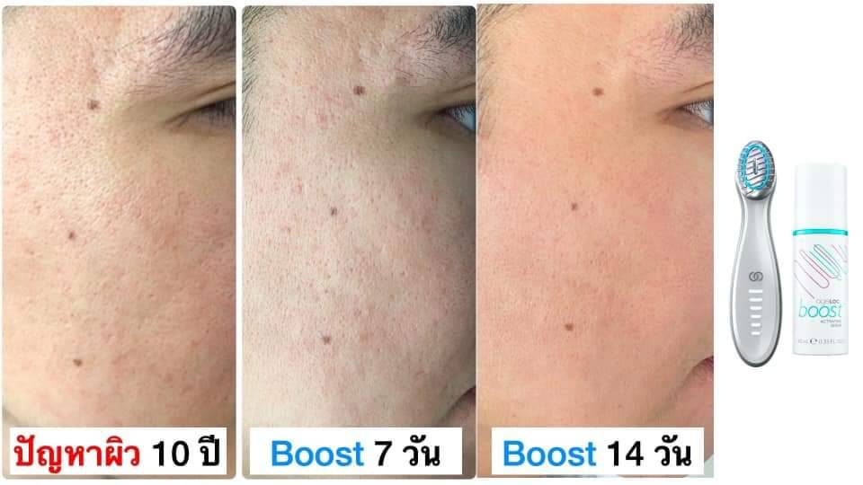 <Img src =”ageloc boost 118.jpg” alt=“ageloc boost before & after”>