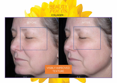 <Img src =”beauty focus collagen+.jpg” alt=“beauty focus collagen+ before & after 2”>