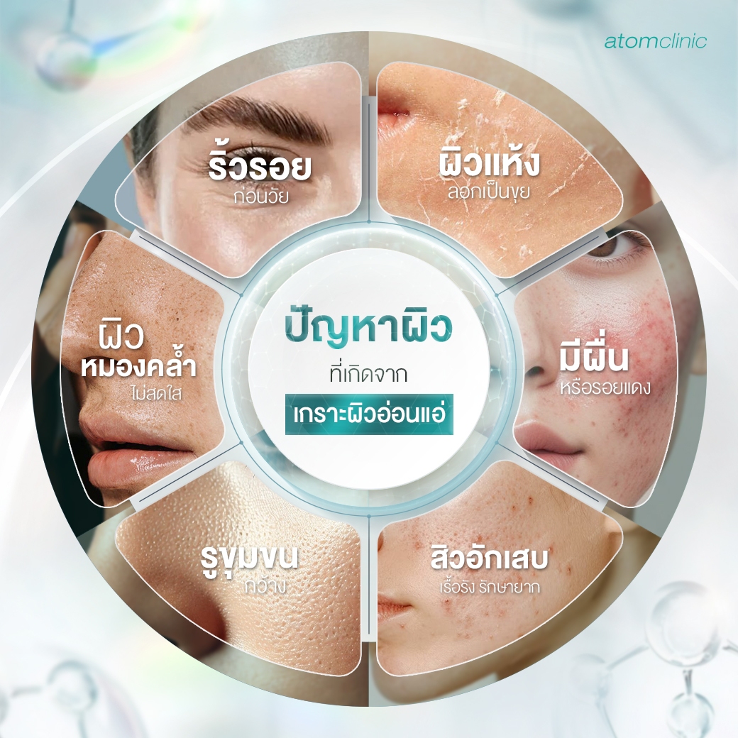 สัญญาณเตือน : ผิวคุณอาจกำลังมีเกราะผิวอ่อนแอ สัญญาณเตือน : ผิวคุณอาจกำลังมีเกราะผิวอ่อนแอ