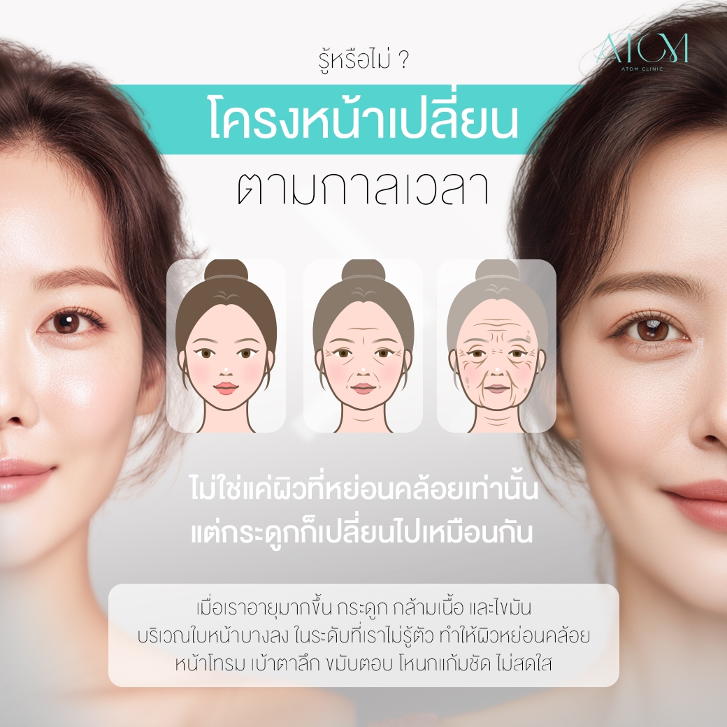 filler ฟิลเลอร์ เทคนิค AT Tri 