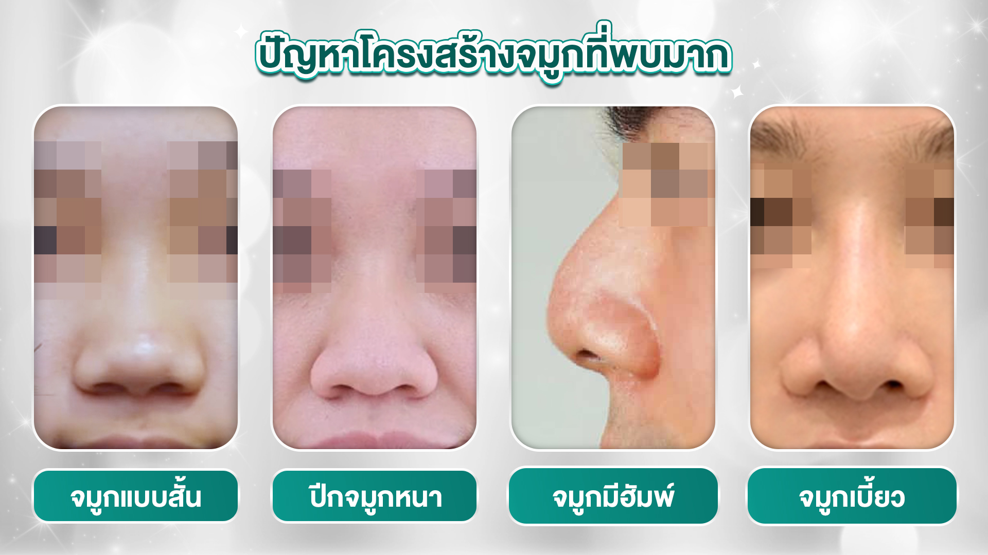 เสริมจมูก