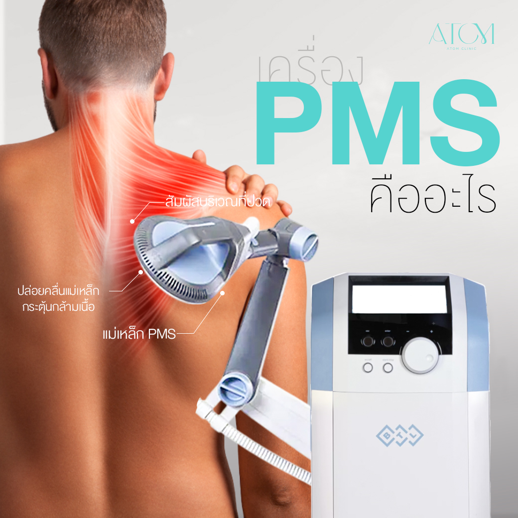 PMS ลดปวดเรื้อรัง