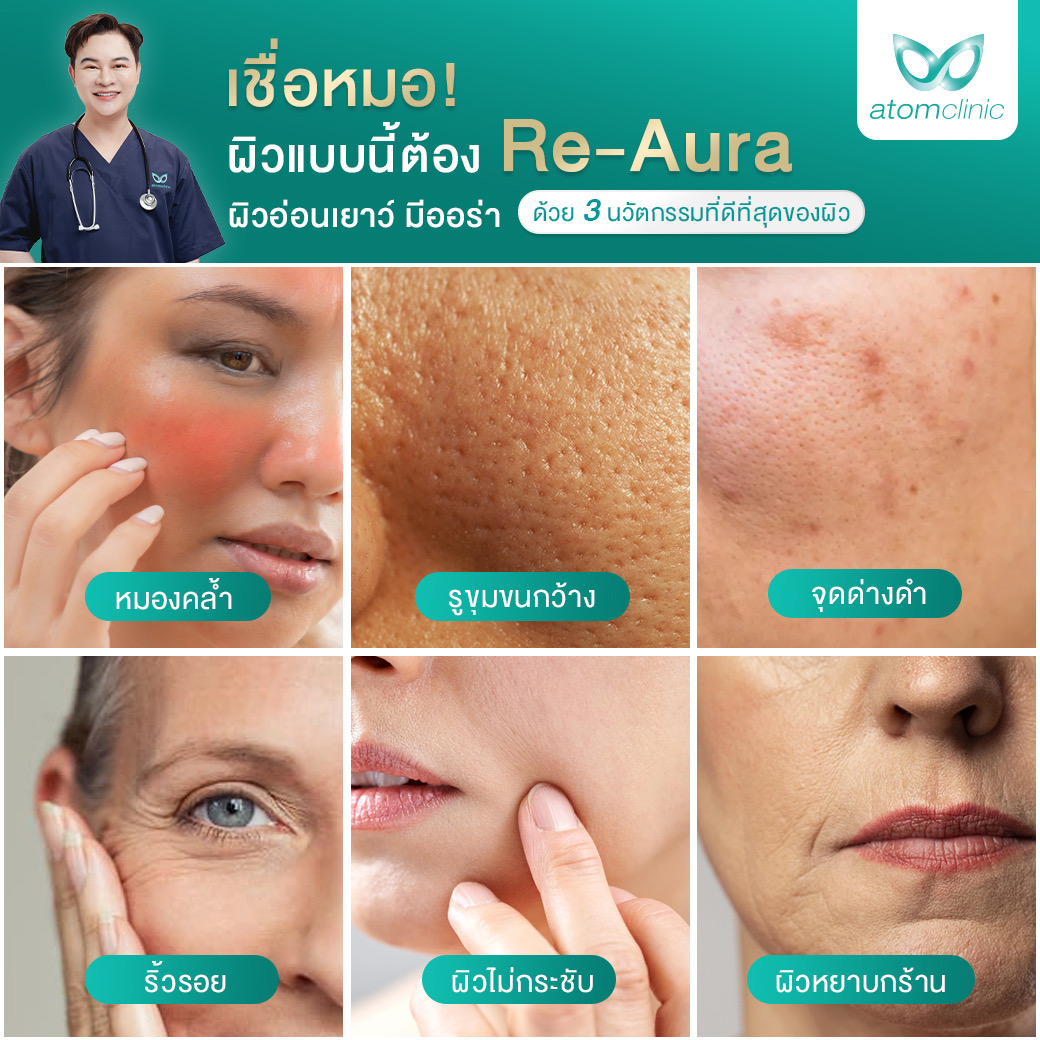 re-aura รีออร่า