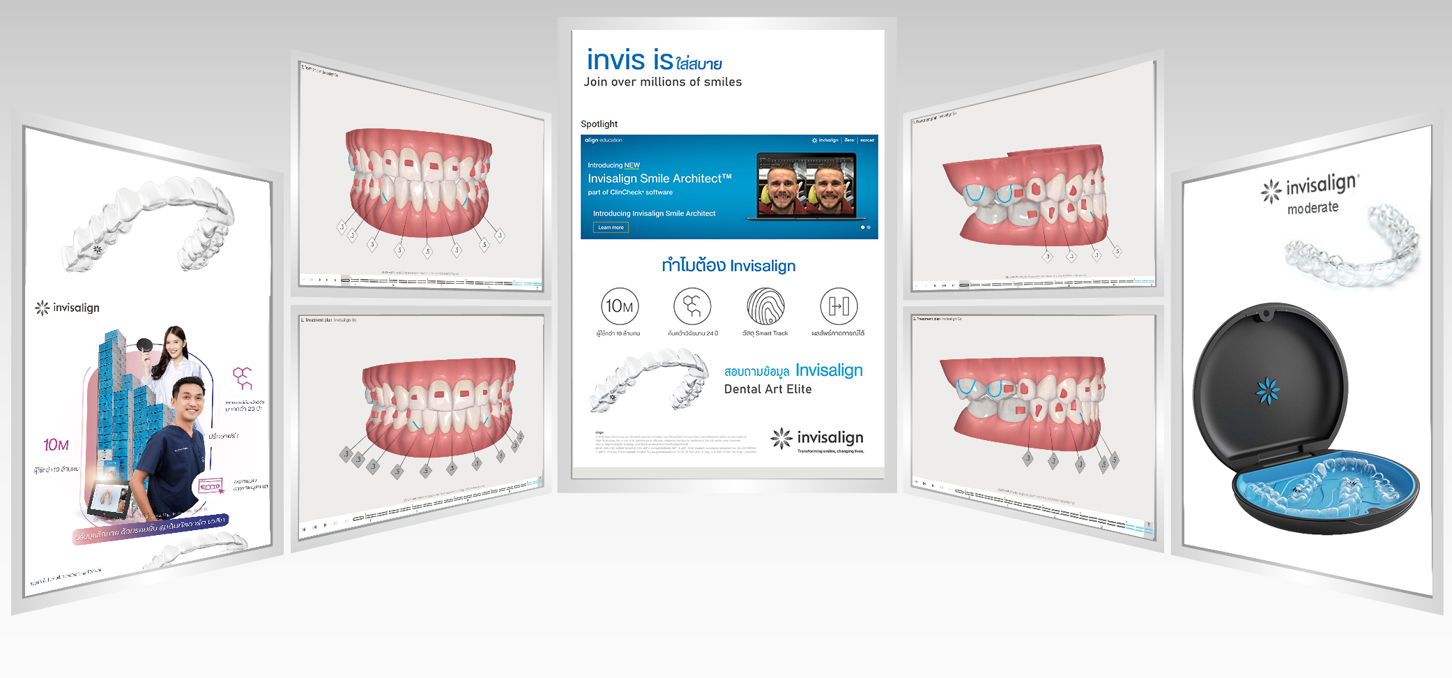 Cq Inkalign การจัดฟันแบบใส invisalign เครื่องมือจัดฟันที่สามารถถอดได้