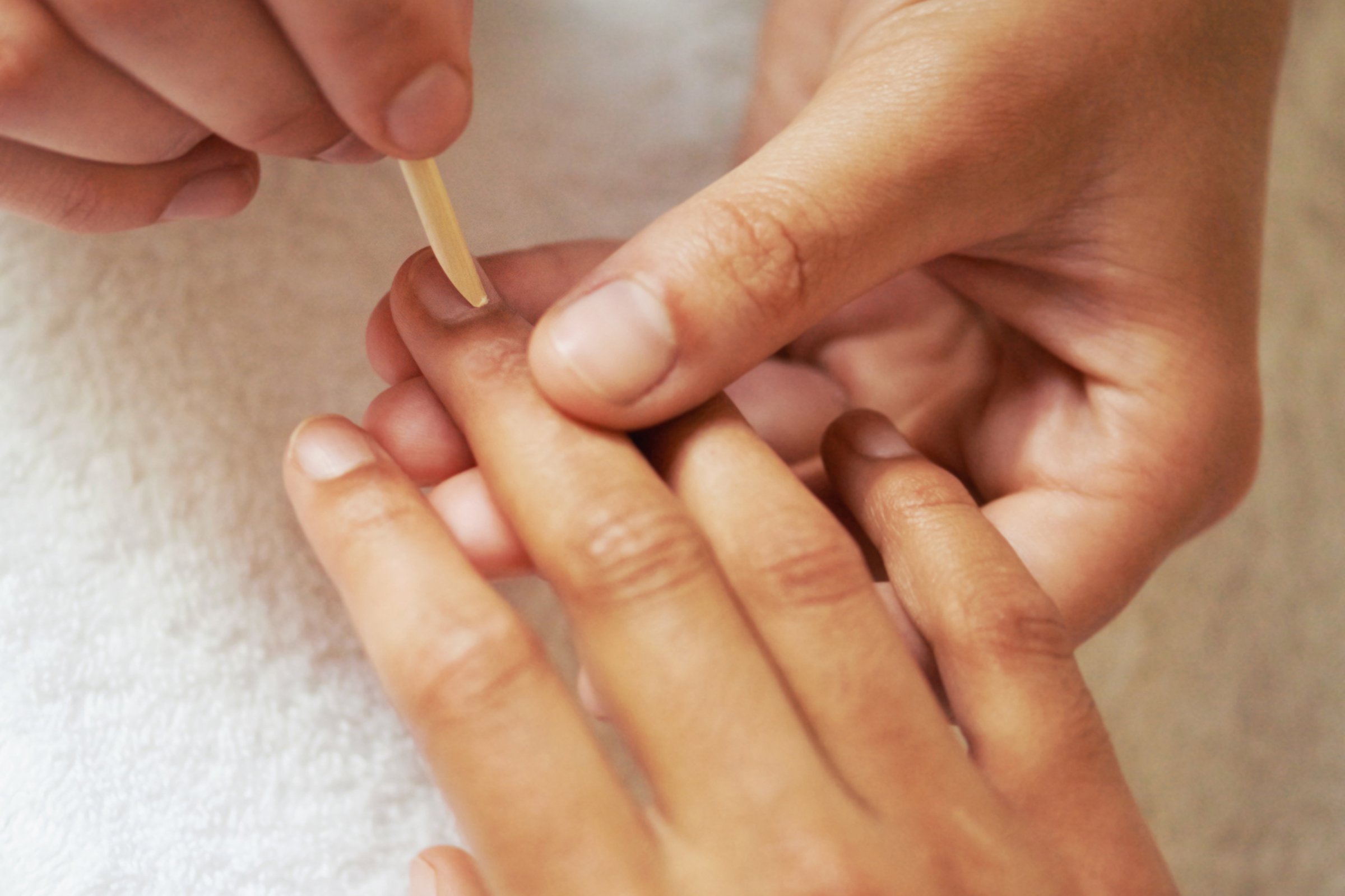 ใช้ลิปมันถูรอบๆผิวหนังบริเวณเล็บ การดูเเลผิวหนังบริเวณเล็บ