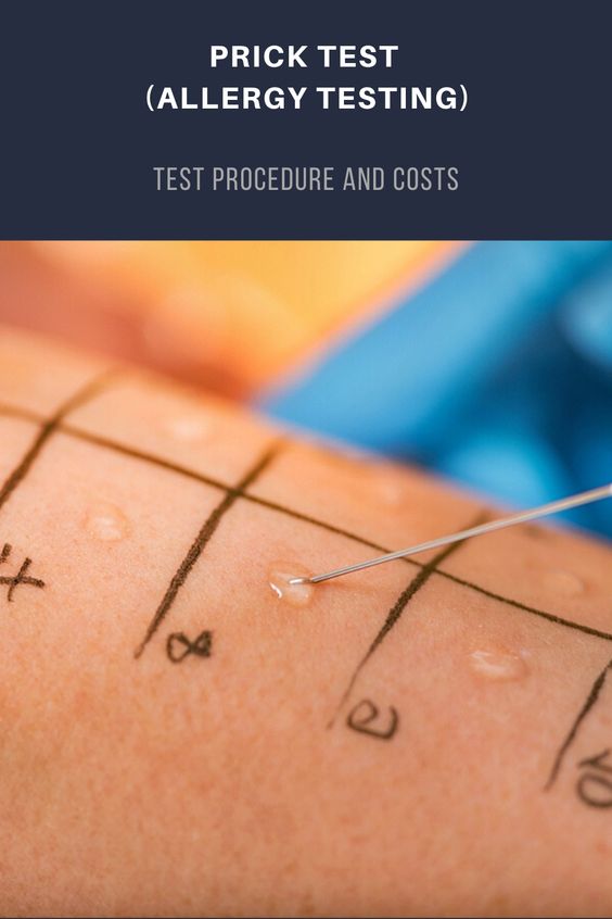 การตรวจสกินเทส วิธีตรวจหาภูมิเเพ้สกินเทส