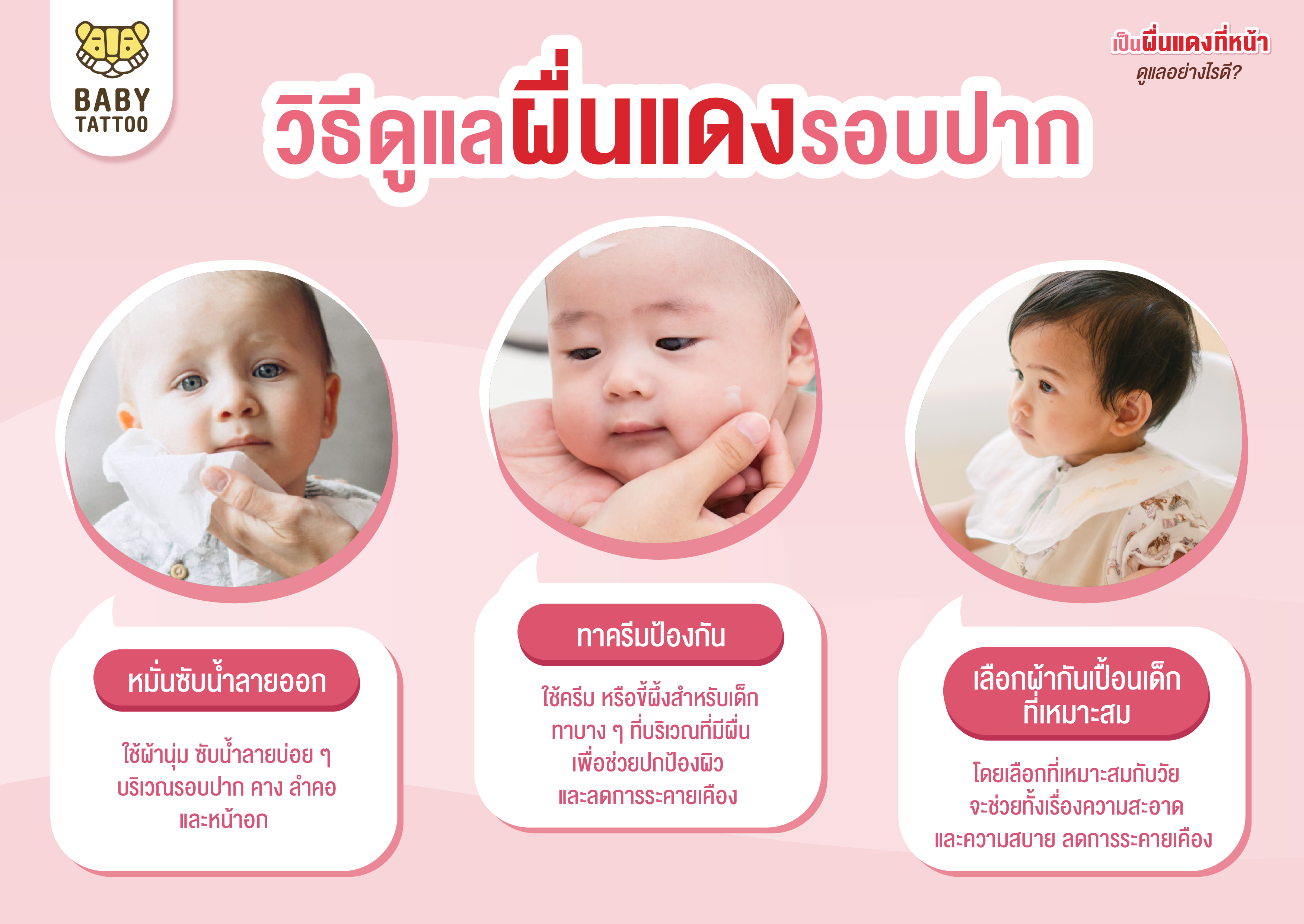 วิธีดูแล ผื่นแดง รอบปากเด็ก