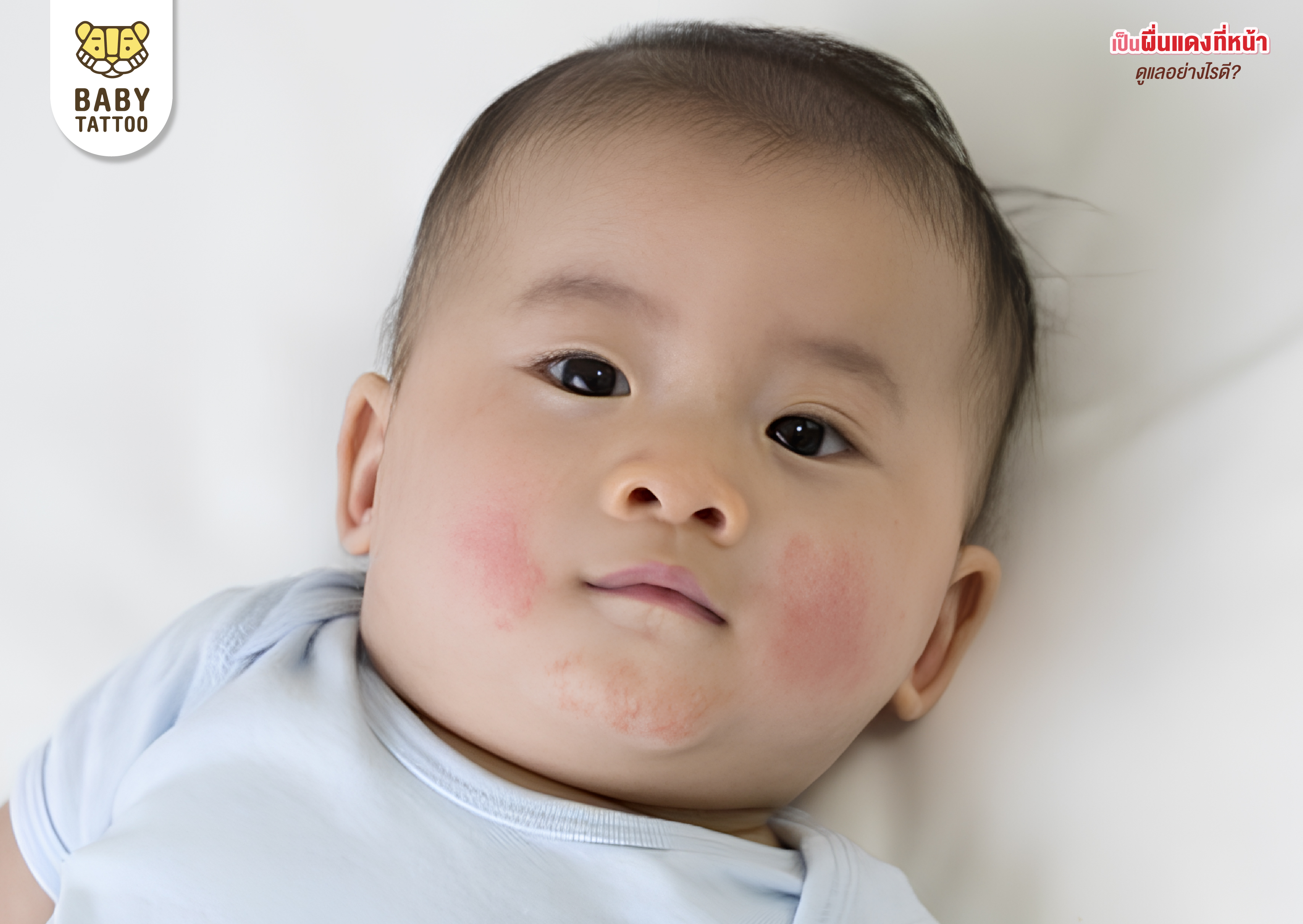 อาการ ผื่นแดงของลูกน้อย