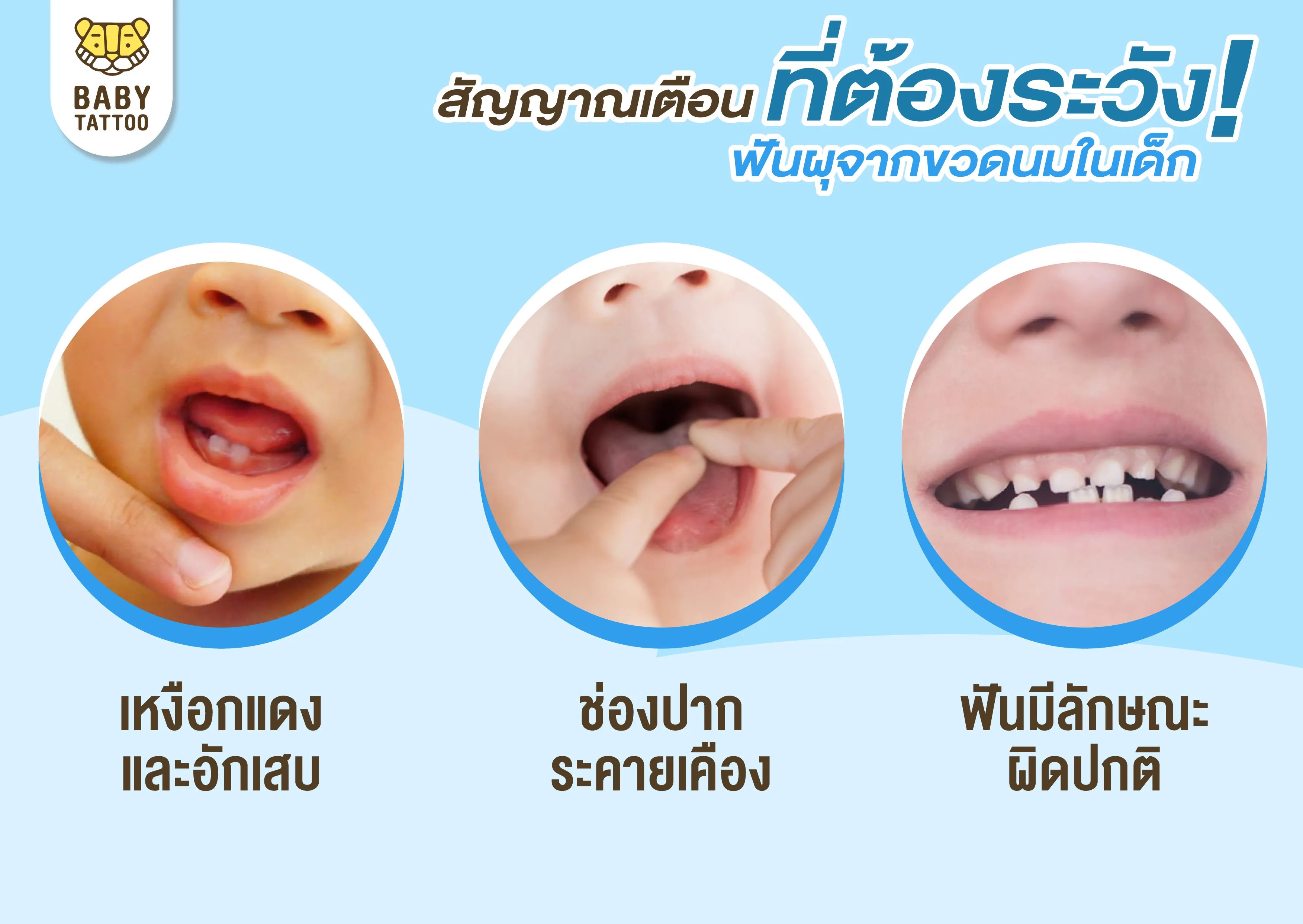 สัญญาณเตือน ระวังฟันผุ ในเด็ก