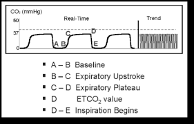 End Tidal CO2 (EtCO2) Monitoring, 50% OFF