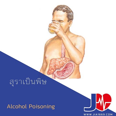 alcohol poisoning