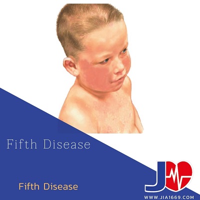 Fifth Disease โรคฟิฟธ์