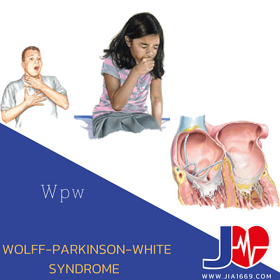 Wolff-Parkinson-White (WPW) syndrome