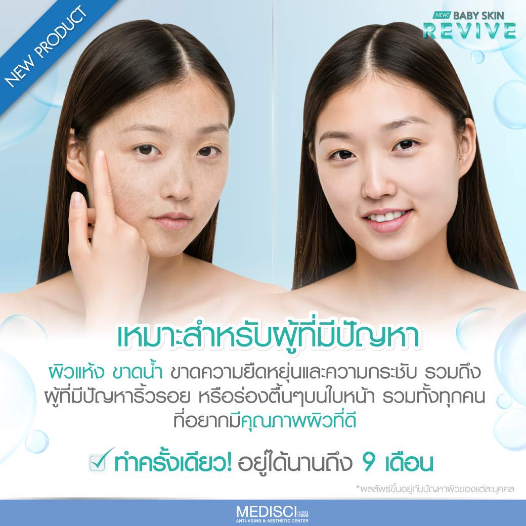 Belotero Revive: Revitalizes Facial Skin to be more gorgeous