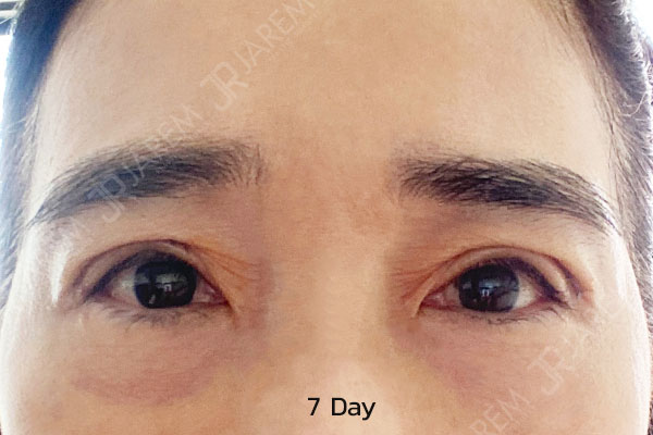 รีวิวทำตา รีวิวตา
