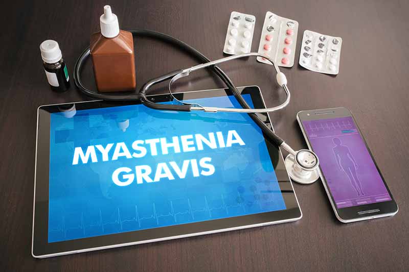 โรคกล้ามเนื้ออ่อนแรง Myasthenia Gravis คือ