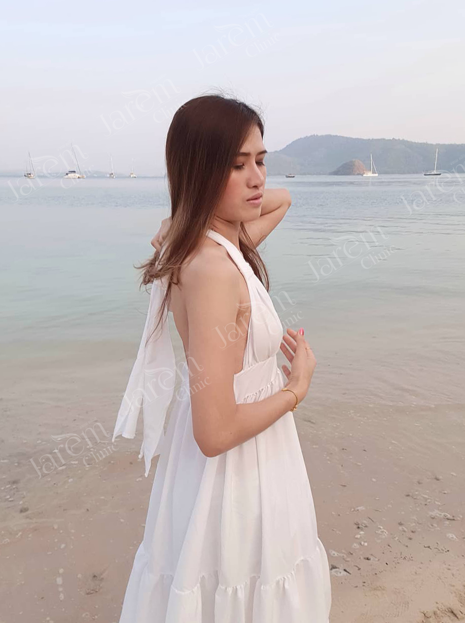 ก่อนเสริมหน้าอก