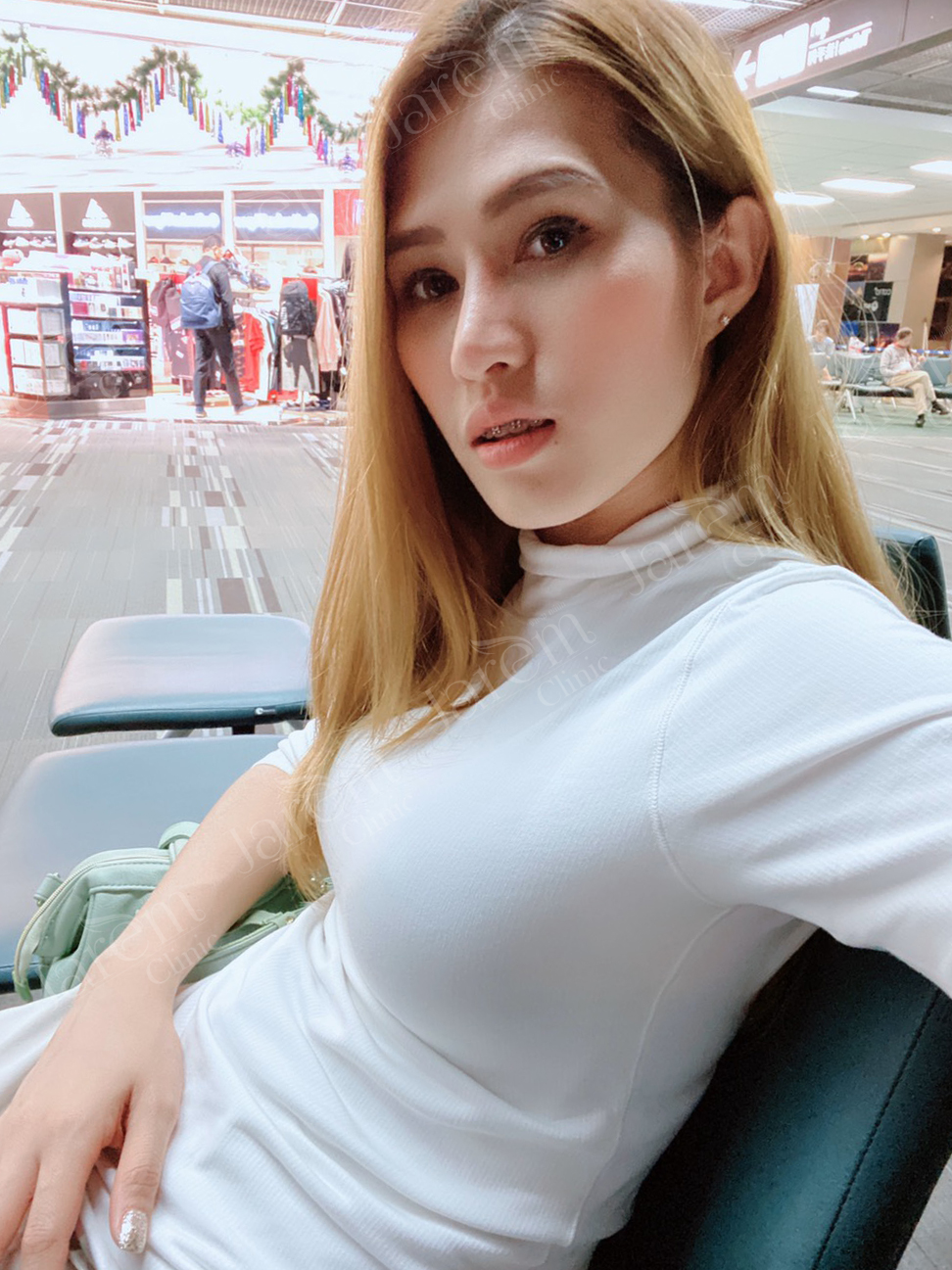 เสริมหน้าอกพอดีตัว1