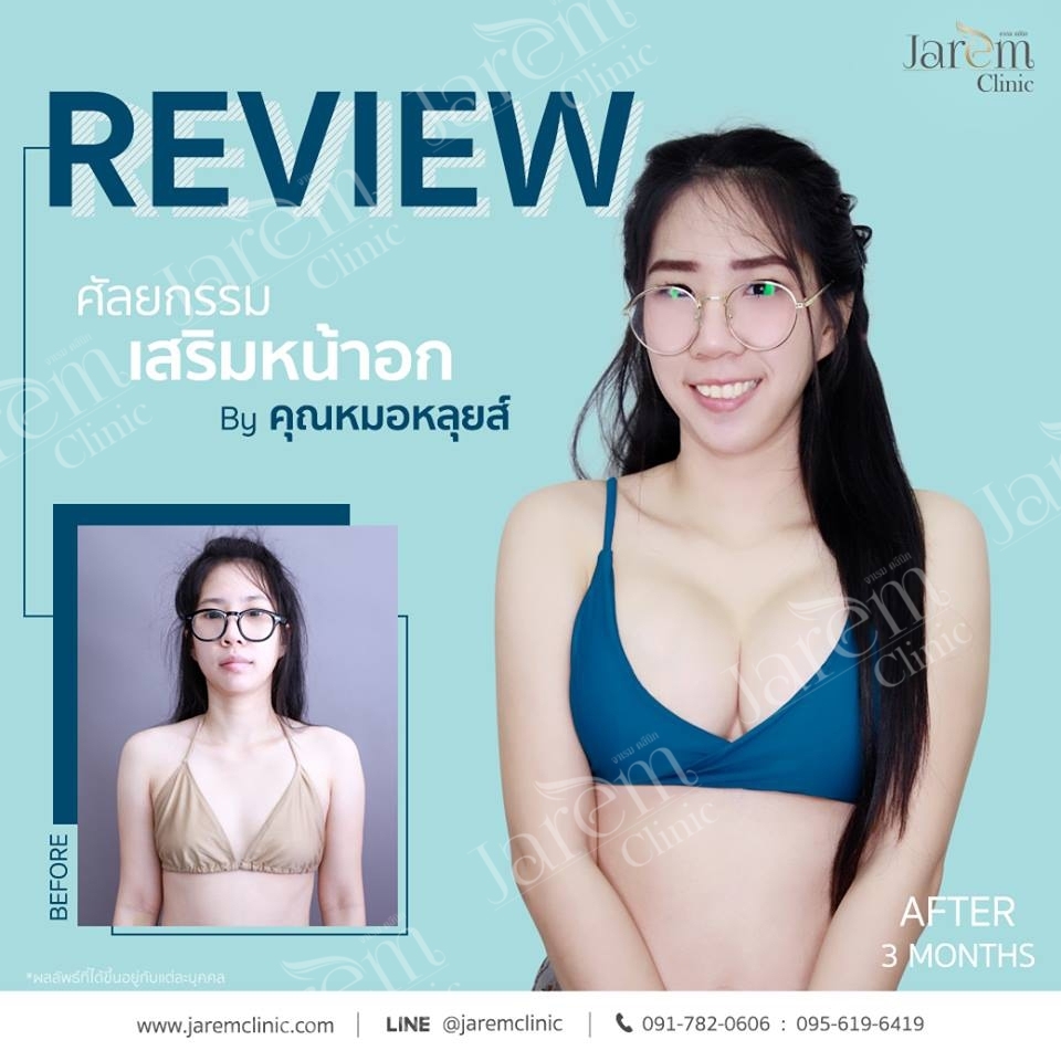อกสวยๆ