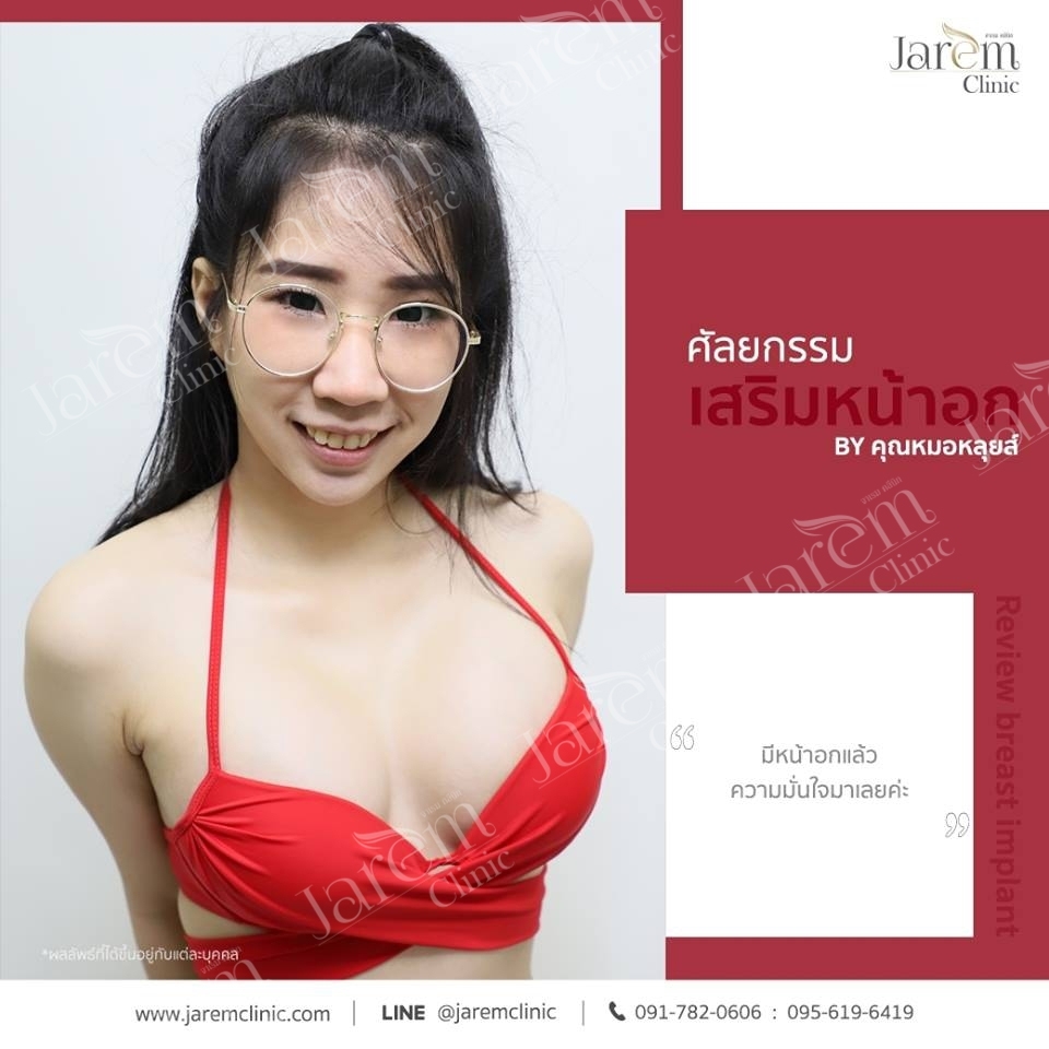 รีวิวทำนม