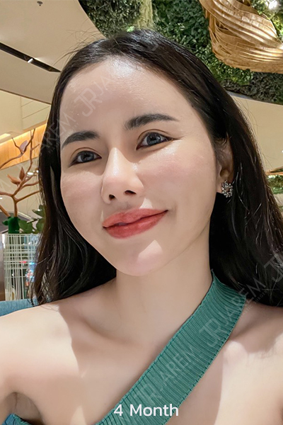 jaremclinic ทำตาสวยๆ