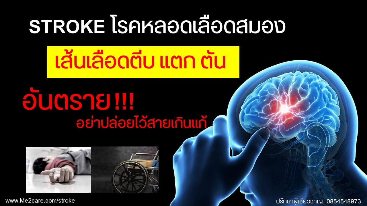 Stroke à¹à¸£à¸à¸«à¸¥à¸à¸