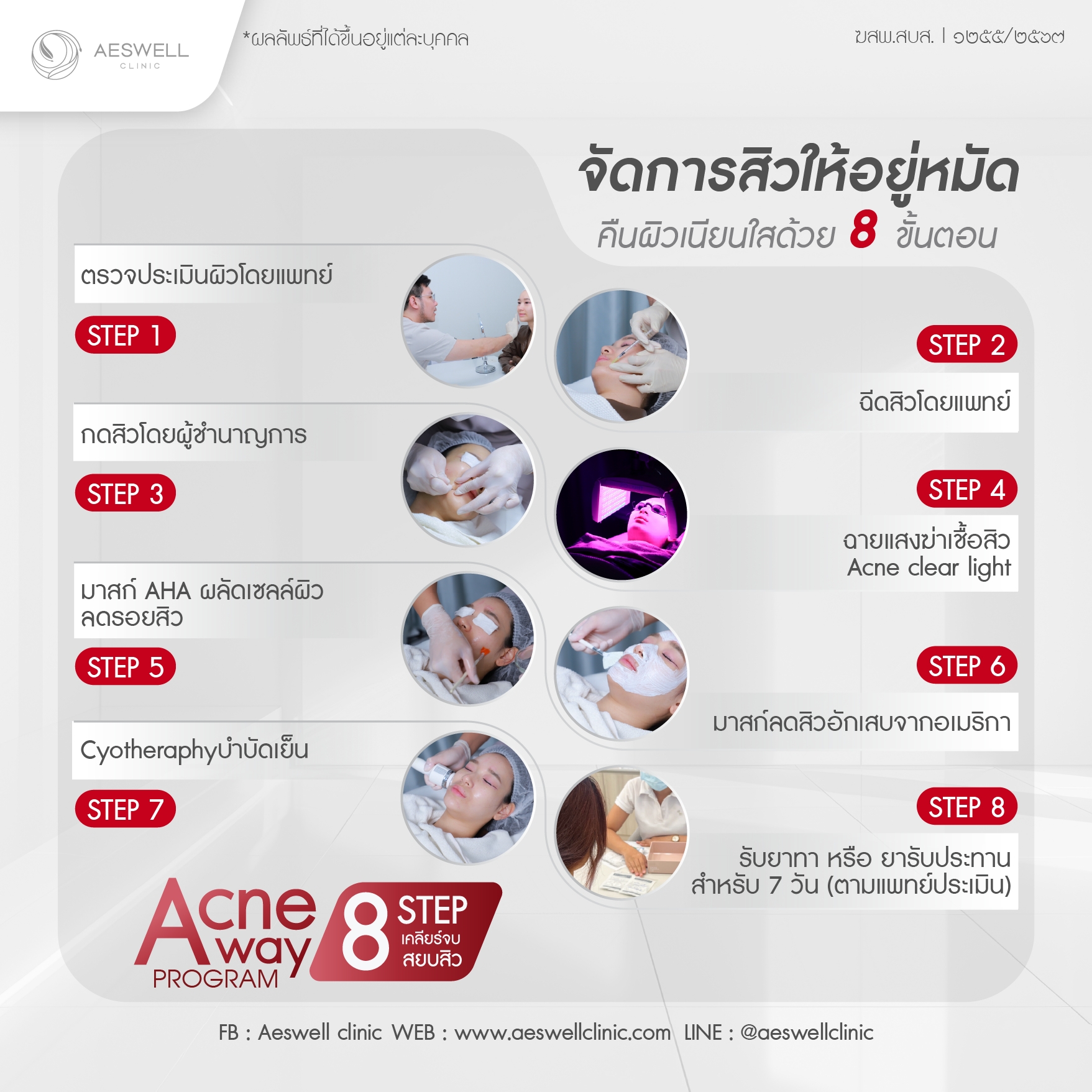 จัดการสิวให้อยู่หมัด คืนผิวเนียนใส ด้วย 8 ขั้นตอน