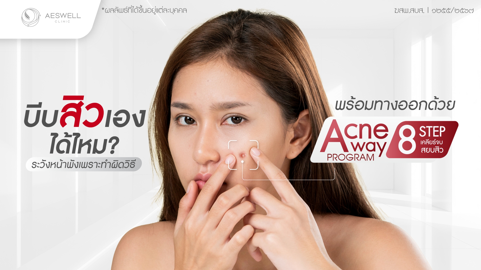 บีบสิวเองได้ไหม? แก้หน้าพังด้วย Program Acne Away
