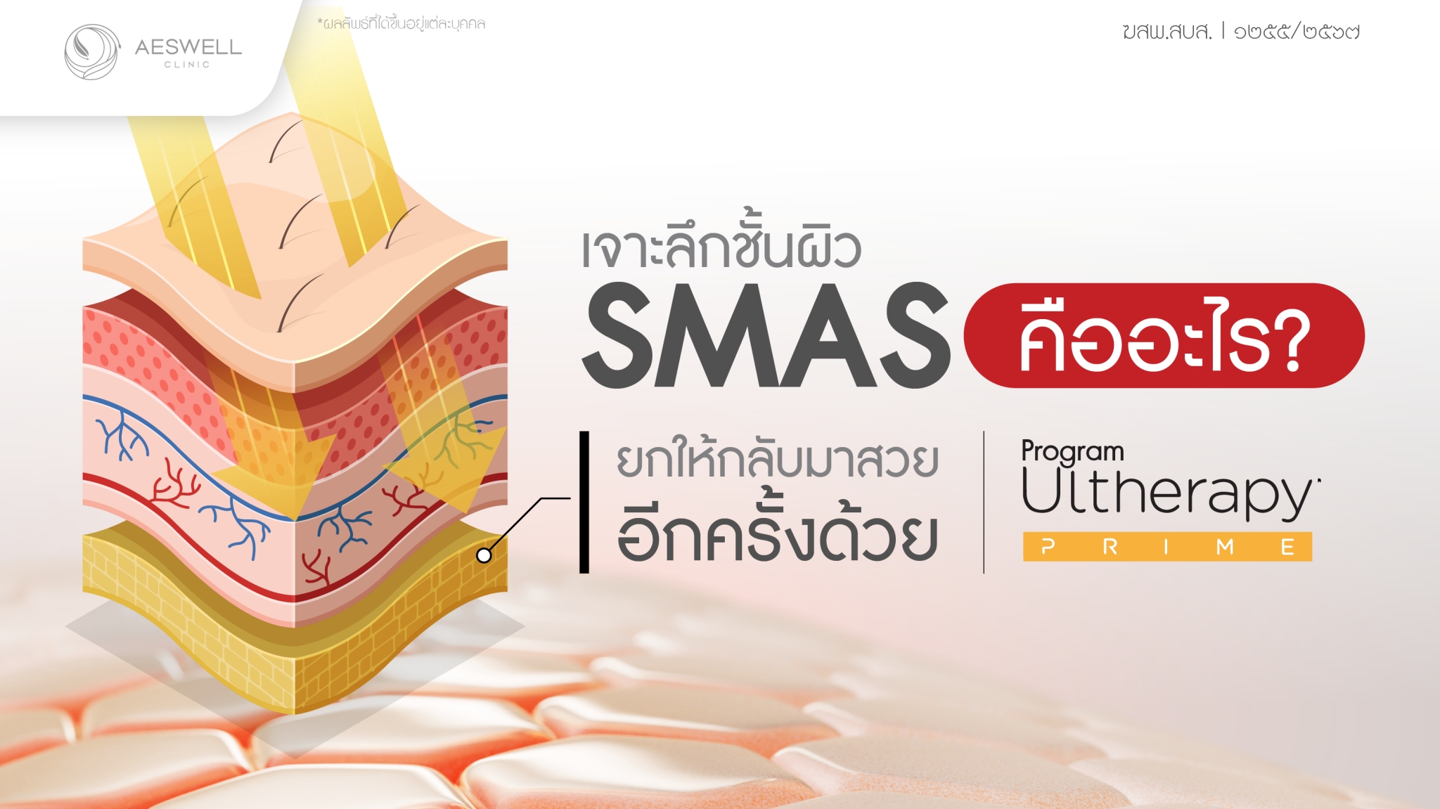 เจาะลึก ชั้น SMAS คืออะไร? ยกให้กลับมาสวยอีกครั้งด้วย โปรแกรม Ultherapy Prime