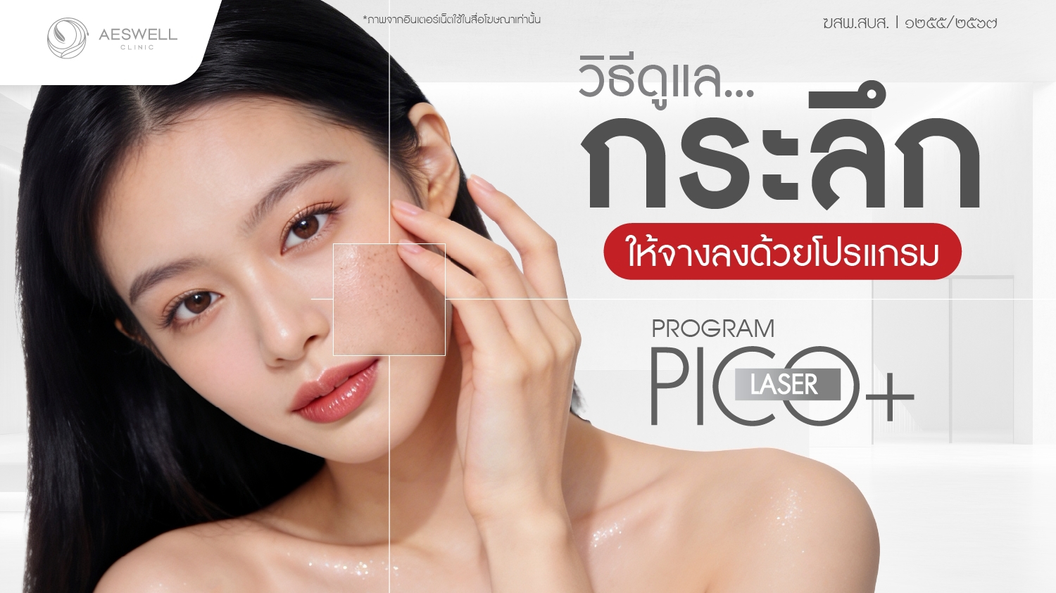วิธีดูแลกระลึก ให้จางลงด้วย โปรแกรม Pico Laser