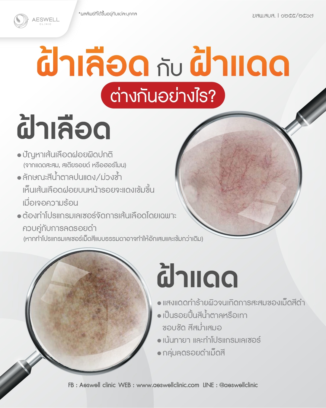 ฝ้าเลือดกับฝ้าแดดต่างกันอย่างไร
