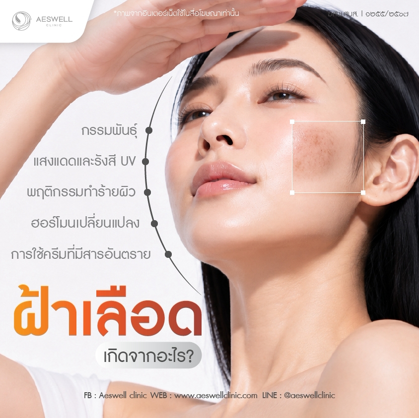 ฝ้าเลือดเกิดจากอะไร สาเหตุหลักที่ต้องรู้