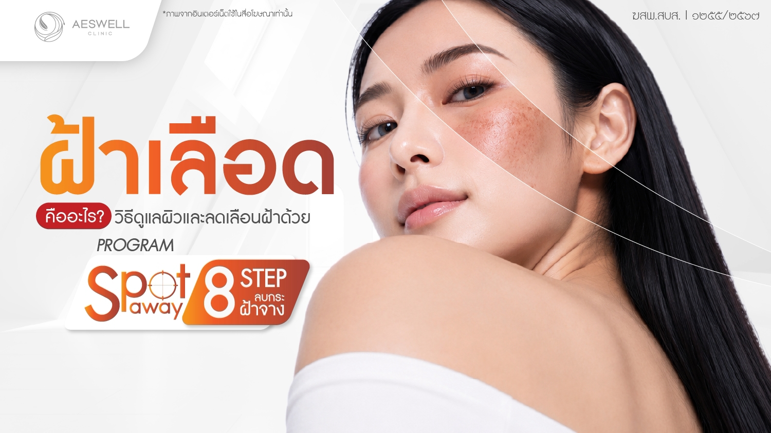 ฝ้าเลือด คืออะไร? วิธีดูแลผิวและลดเลือนฝ้าด้วย โปรแกรม Spot Away