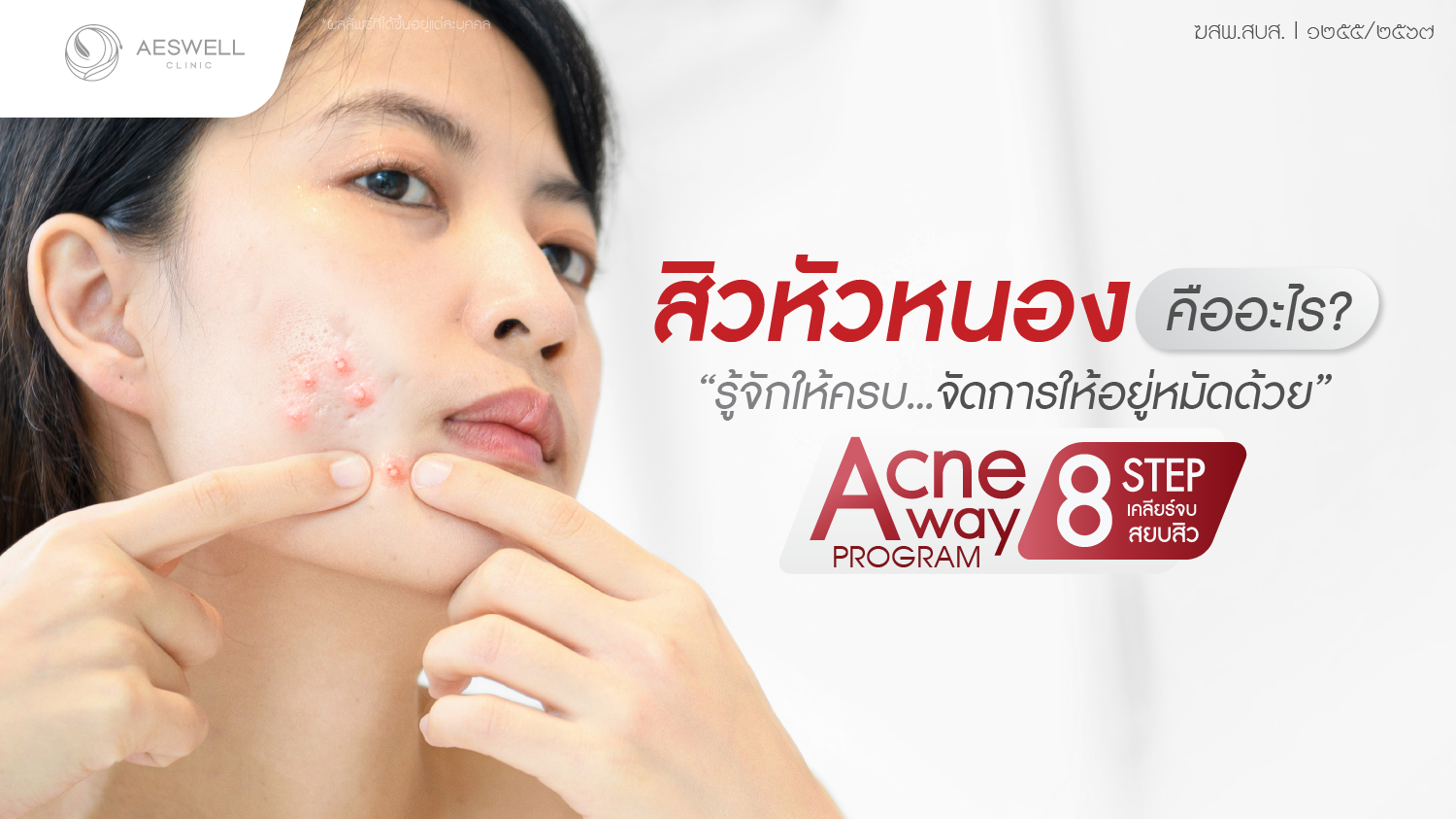 "สิวหัวหนอง คืออะไร? รู้จักให้ครบ จัดการให้อยู่หมัดด้วย โปรแกรม Acne Away"