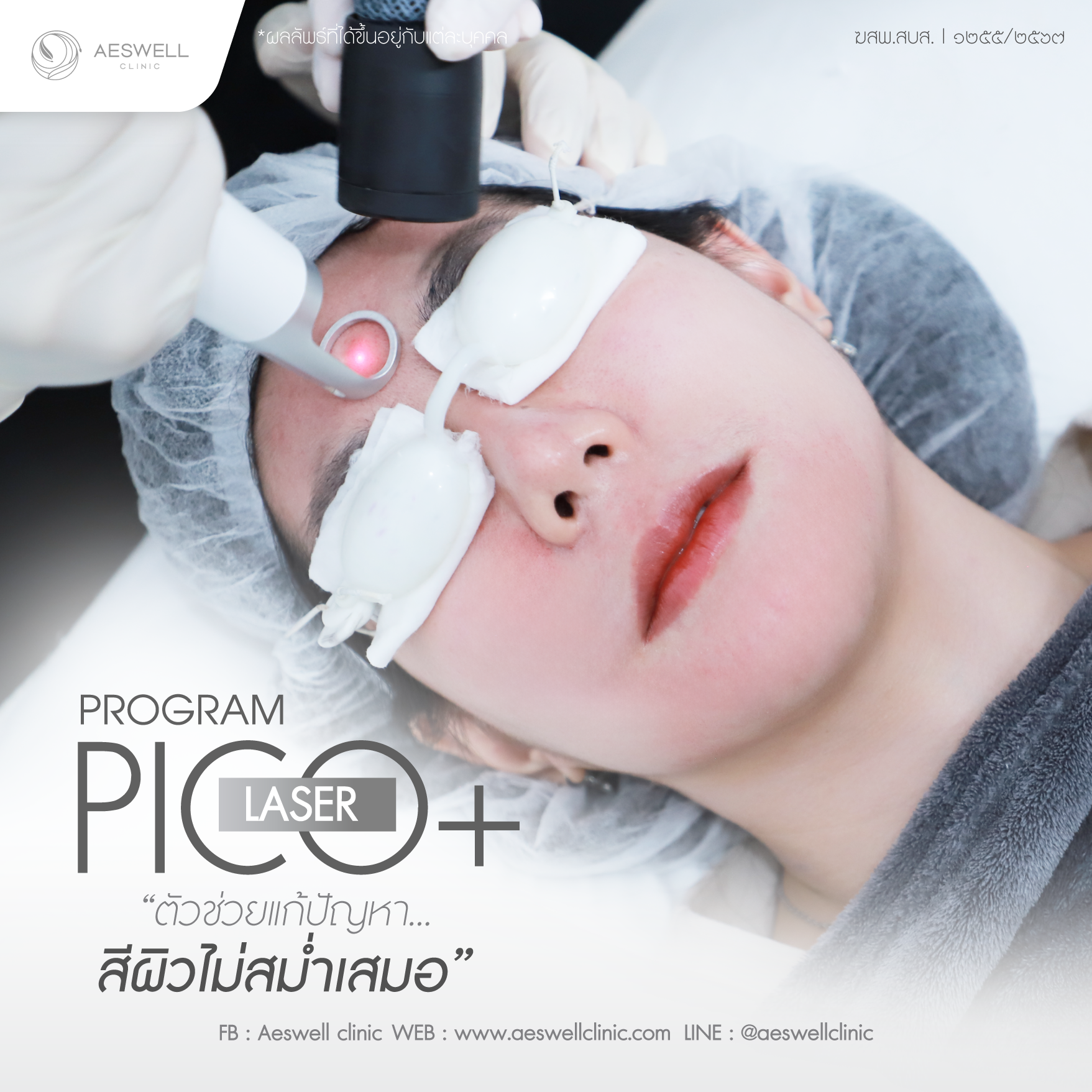 โปรแกรม Pico Laser ตัวช่วยแก้ปัญหาสีผิวไม่สม่ำเสมอ