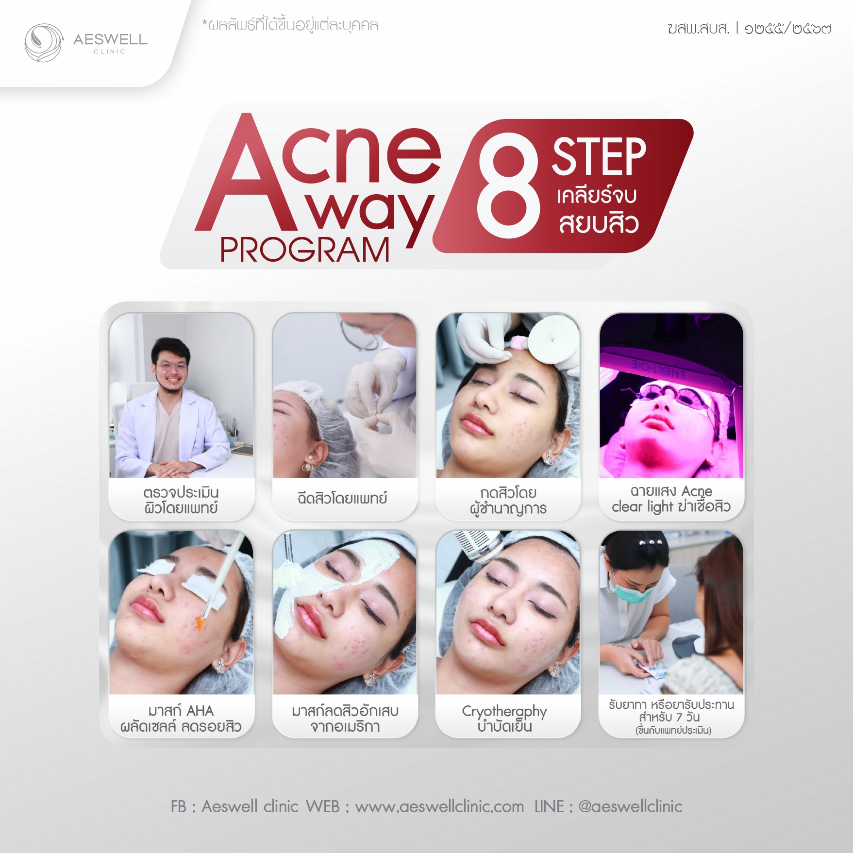 จัดการสิวหัวหนองด้วย โปรแกรม Acne Away