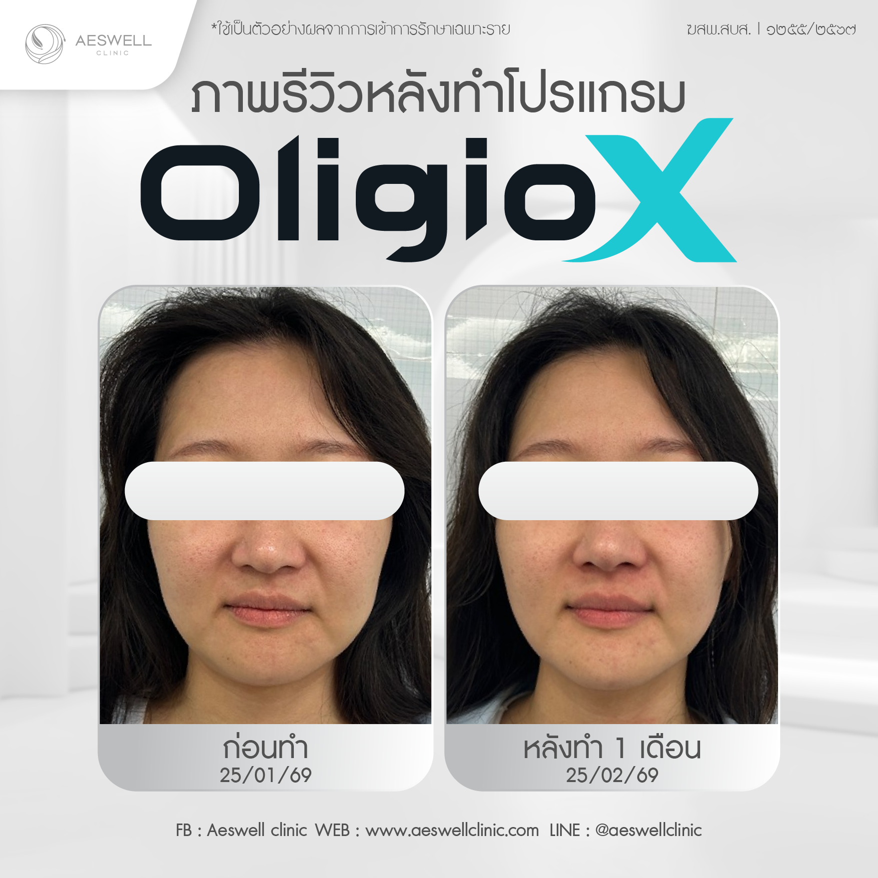ภาพรีวิวผู้ใช้งานจริง โปรแกรม Oligio X