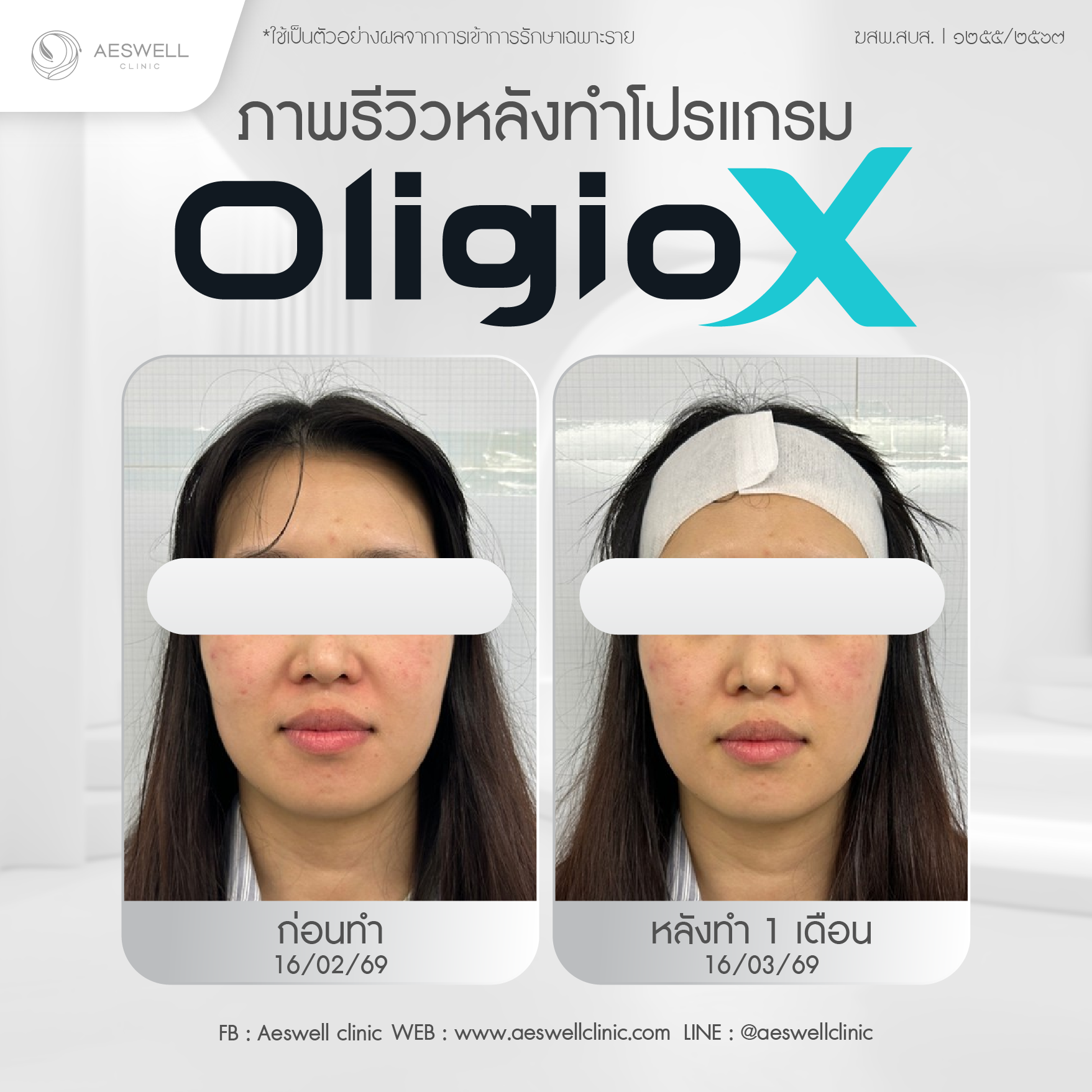 ภาพรีวิวผู้ใช้งานจริง โปรแกรม Oligio X