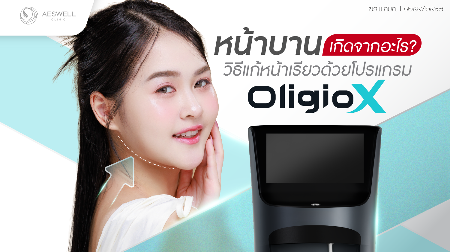ปัญหาหน้าบาน และกรอบหน้าไม่ชัด คือลักษณะแบบไหน?