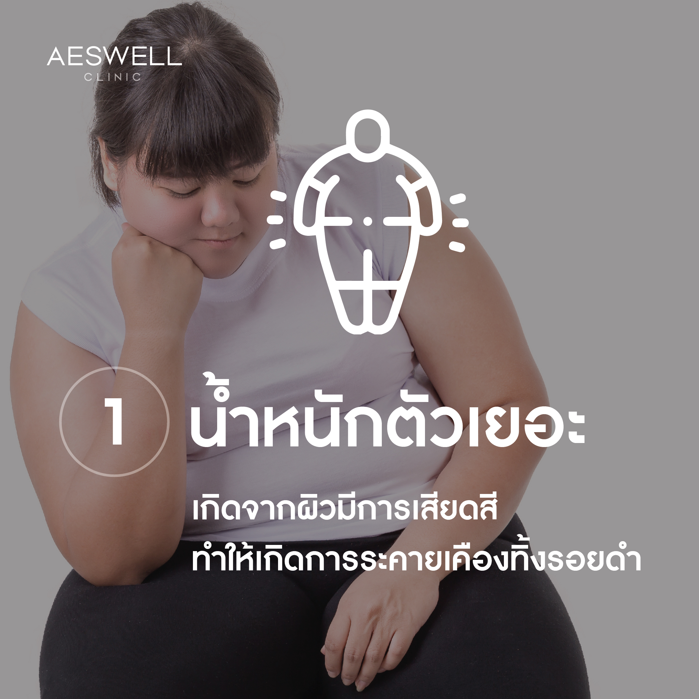 เกิดจากผิวมีการเสียดสี เกิดจากผิวมีการเสียดสี