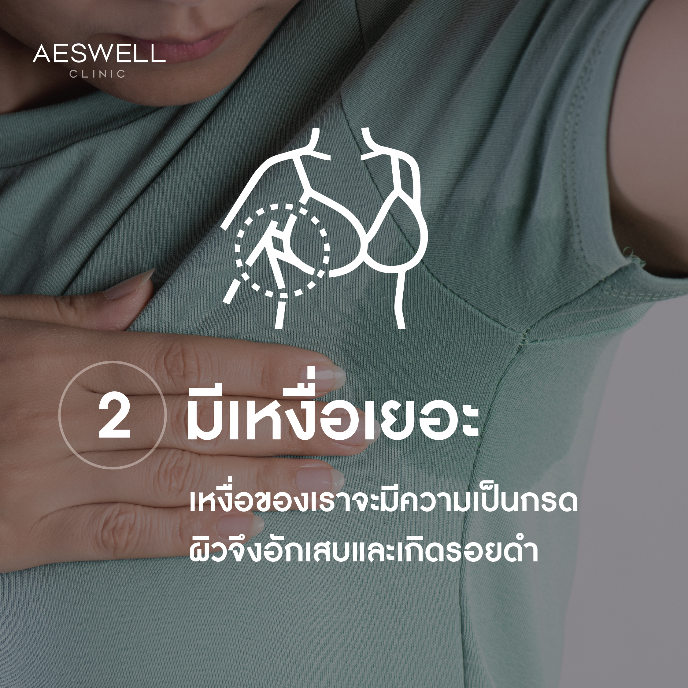 เกิดจากการมีเหงื่อเยอะ เกิดจากการมีเหงื่อเยอะ