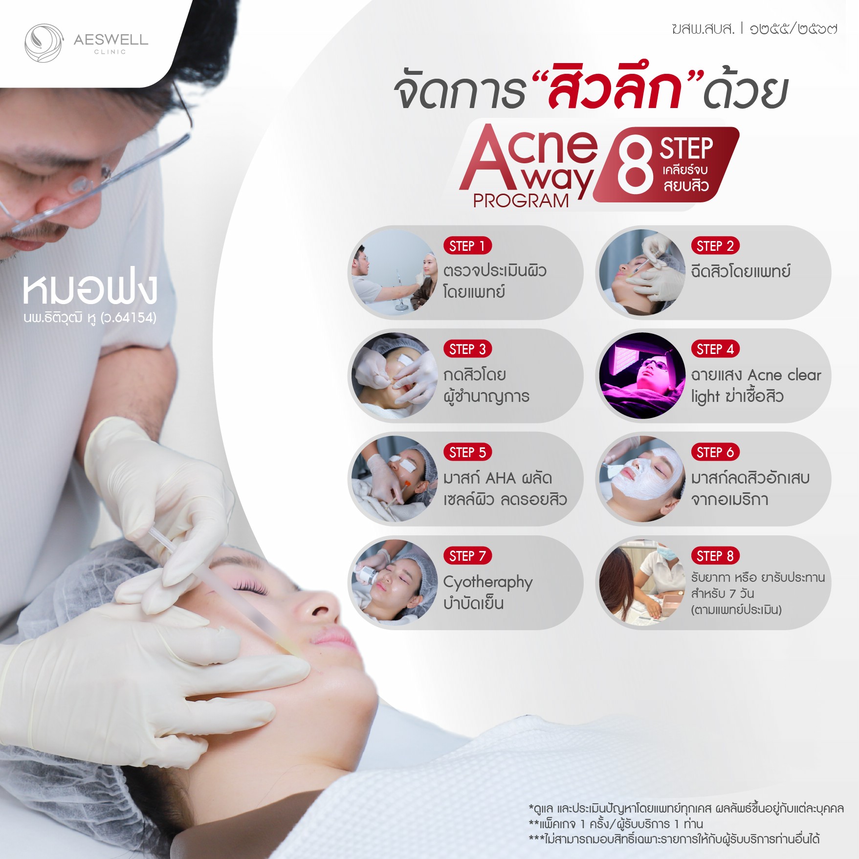 จัดการปัญหาสิว ด้วยการรักษา 8 ขั้นตอน ด้วย โปรแกรม Acne Away