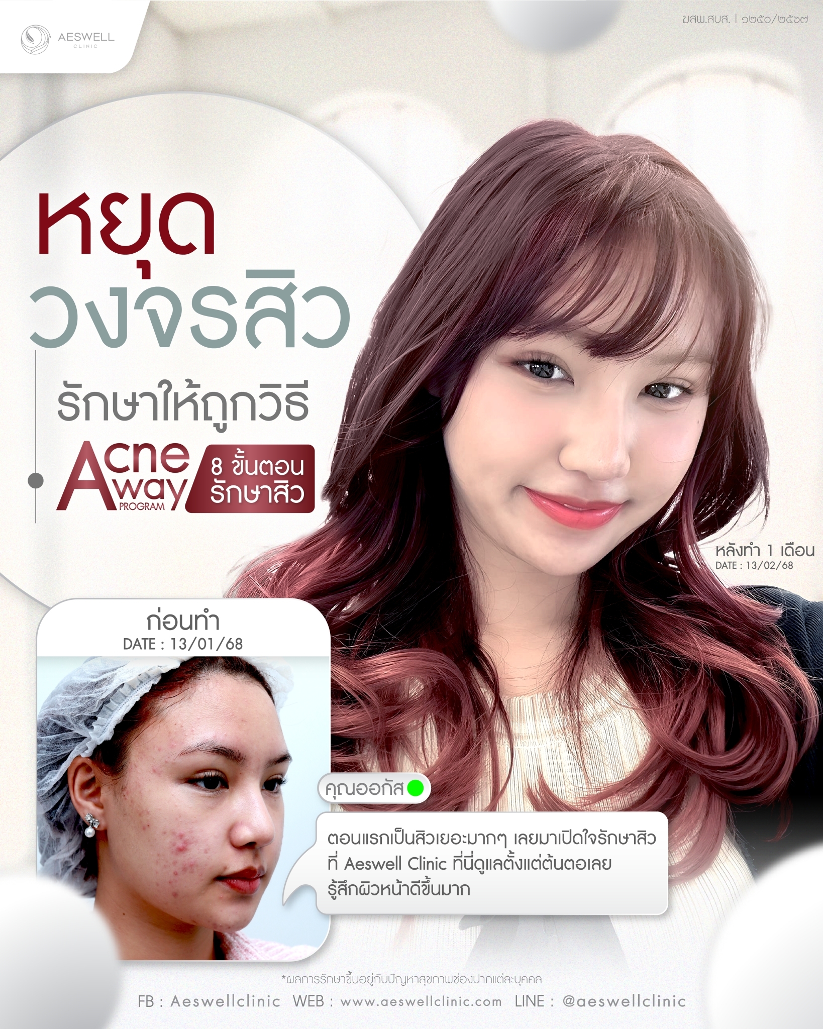 โปรแกรม Acne Away