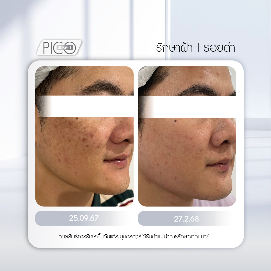 รีวิว โปรแกรม Spot Away